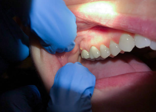 Best Pediatric Emergency Dentist in Mangum, OK