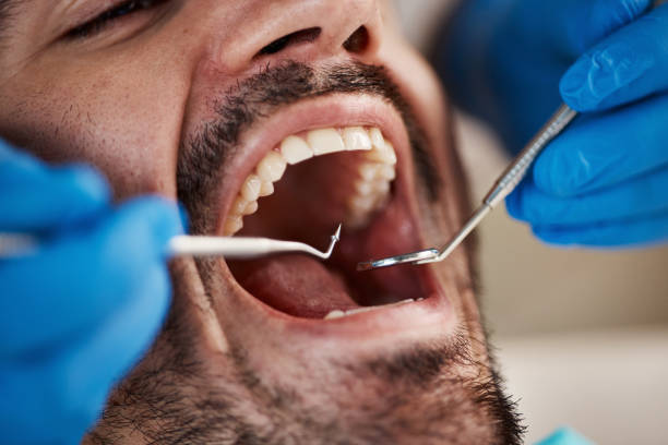 Best Emergency Dental Extractions in Mangum, OK